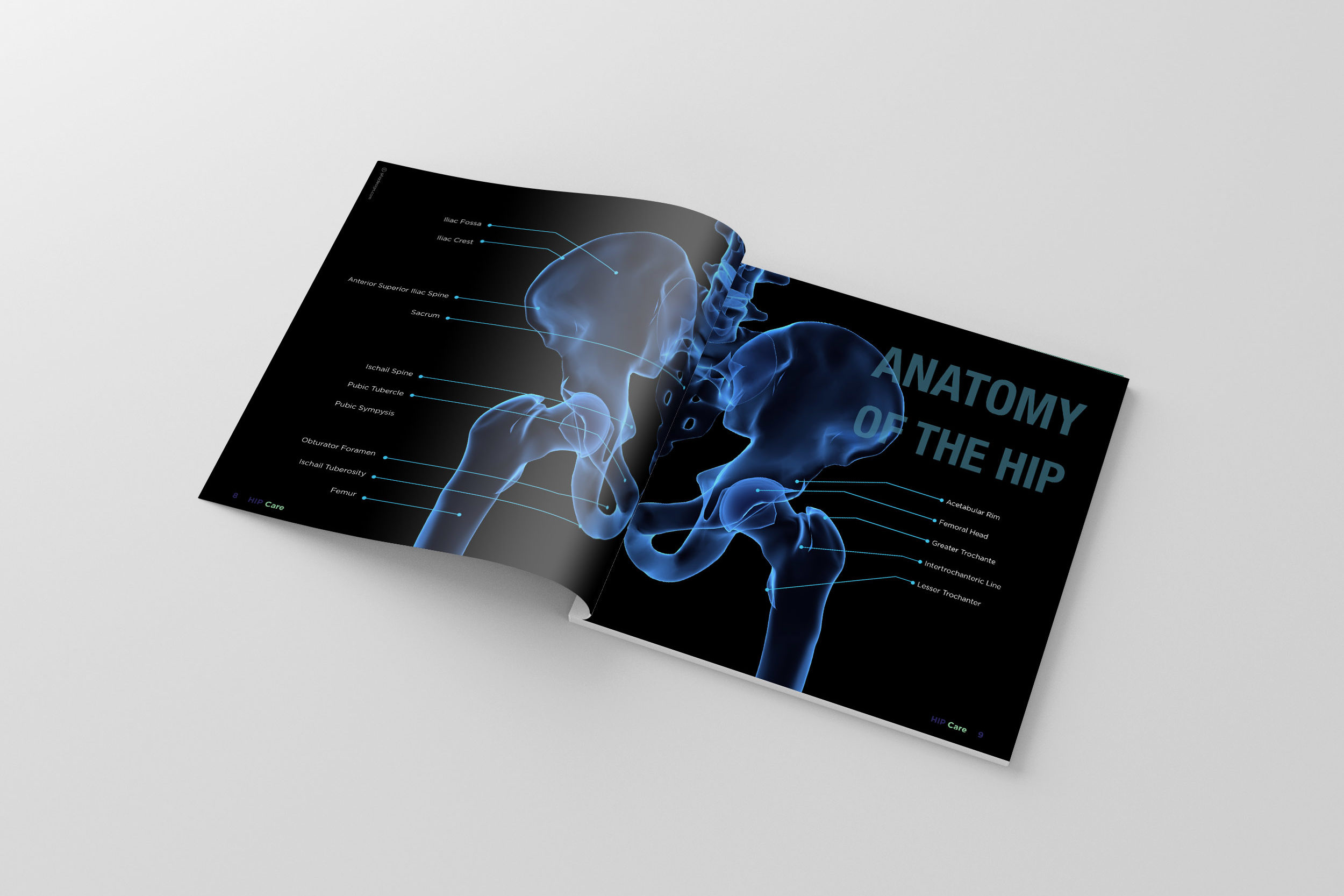 Hip replacement Brochure Design